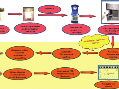 Schematic-representation-of-GeneXpert-technology-depicting-the-step-wise-procedure-of-the